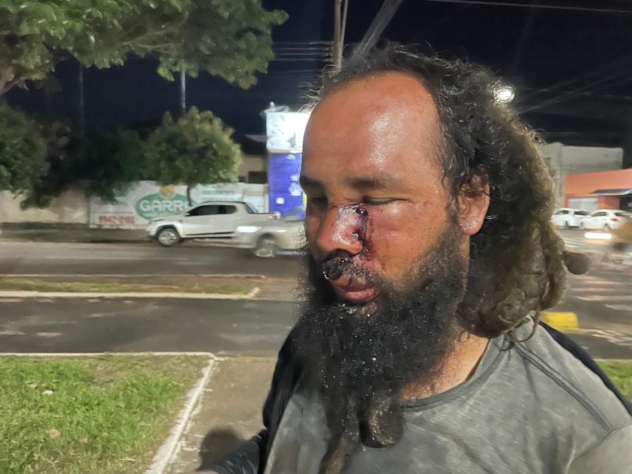 Morador de rua que não “faz mal’ a ninguém tem nariz quebrado após ser brutalmente espancado em Três Lagoas 